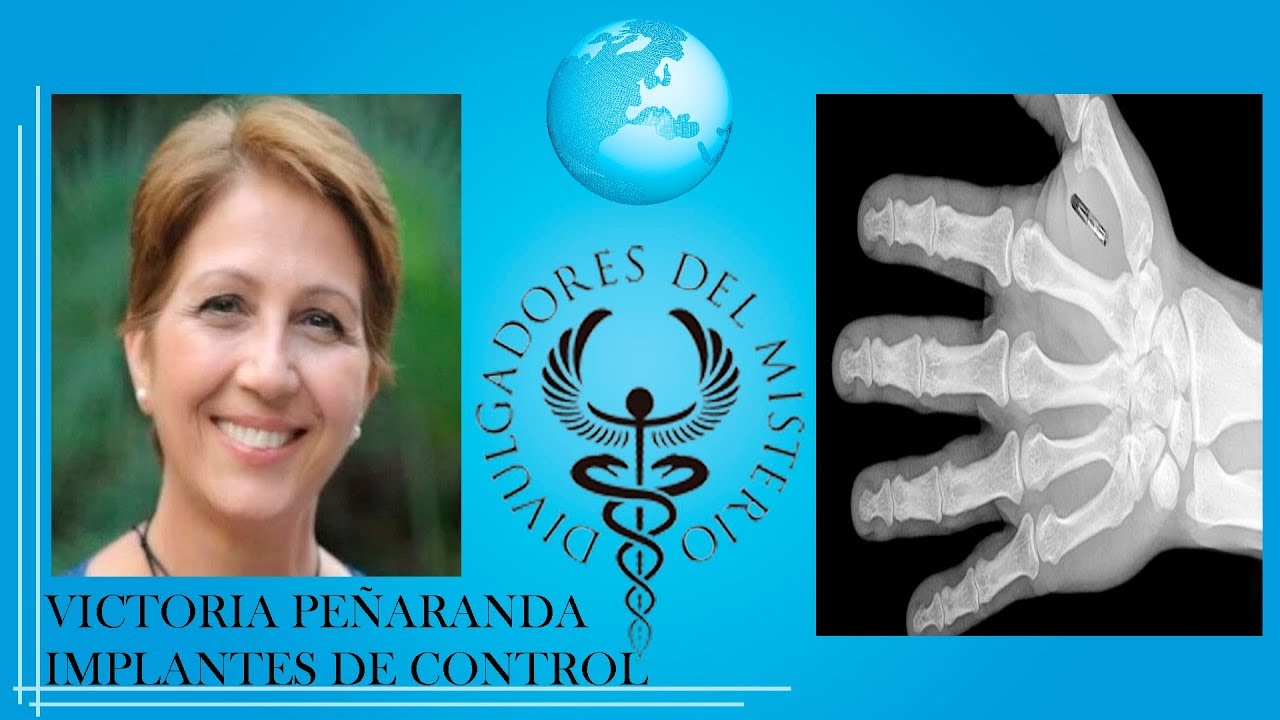 IMPLANTES DE CONTROL con VICTORIA PEÑARANDA