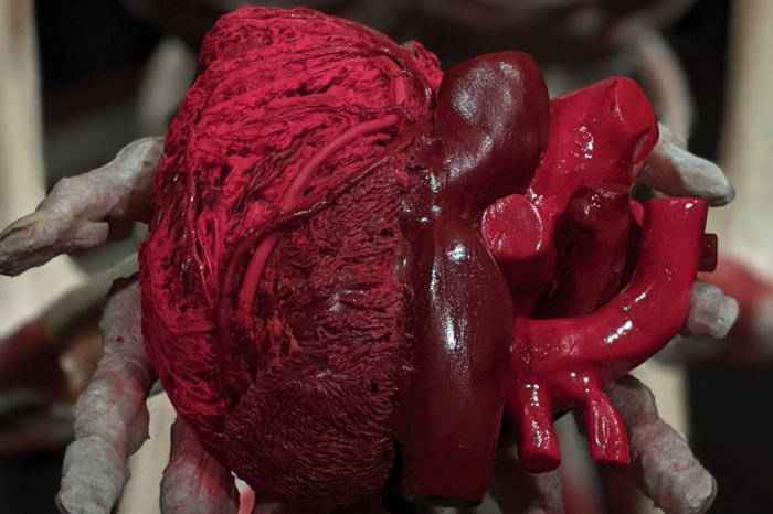 Hay un hombre vivo con el corazón de un cerdo latiendo en su interior