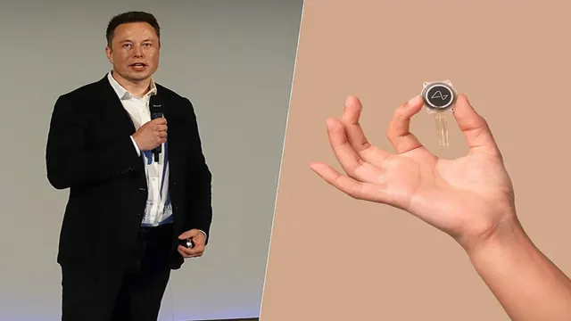 El primer humano con un implante de Neuralink se recupera bien