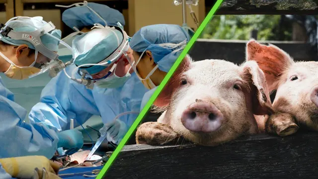 Una empresa asegura tener la solución para la escasez de órganos para trasplantes humanos