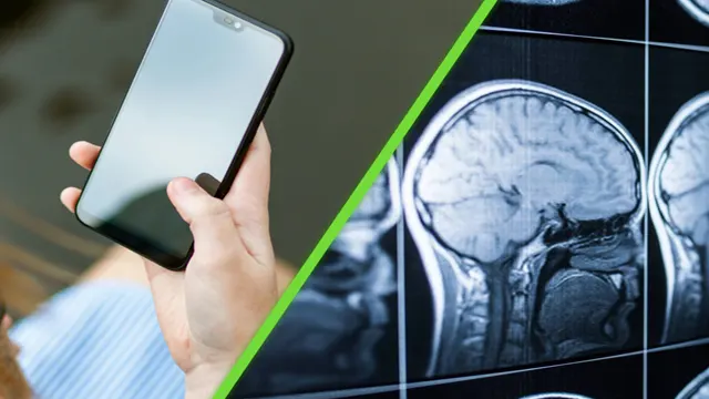 Los celulares y el cáncer cerebral no tienen relación
